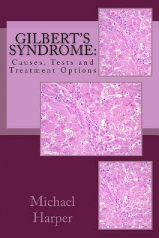 Kniha Gilbert's Syndrome: Causes, Tests and Treatment Options Michael J Harper Ma