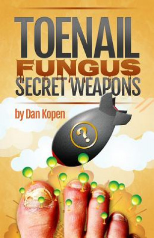 Buch Toenail Fungus Secret Weapons: Uncover over 14 toenail fungus treatments that you can combine to clear your toe nails in under 45 days! Dan Kopen