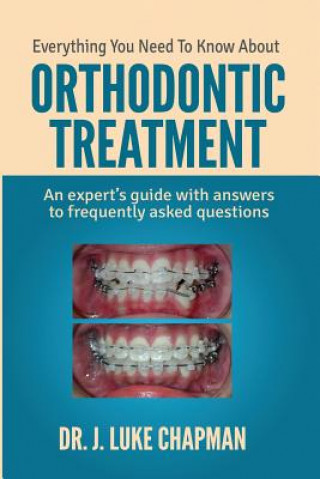 Carte Everything You Need To Know About Orthodontic Treatment: An expert's guide with answers to frequently asked questions Dr J Luke Chapman