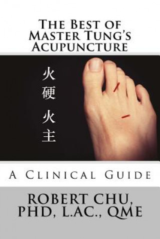 Kniha The Best of Master Tung's Acupuncture: A Clinical Guide Robert Chu Phd