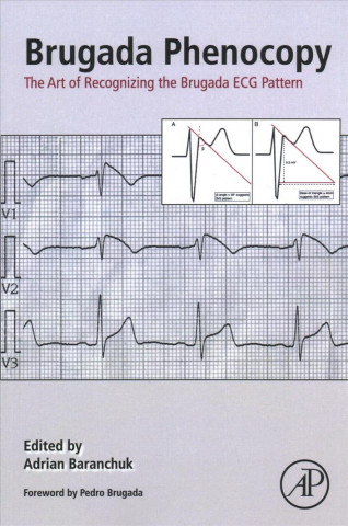 Knjiga Brugada Phenocopy Adrian Baranchuk