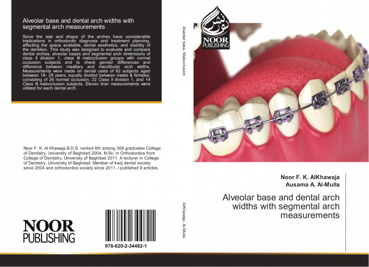 Książka Alveolar base and dental arch widths with segmental arch measurements Noor F. K. AlKhawaja