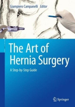 Książka Art of Hernia Surgery Giampiero Campanelli