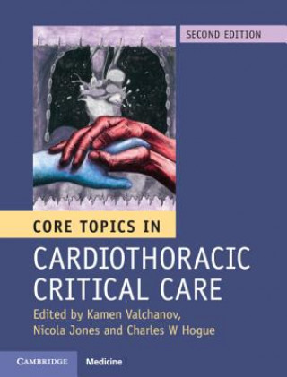 Buch Core Topics in Cardiothoracic Critical Care Kamen Valchanov