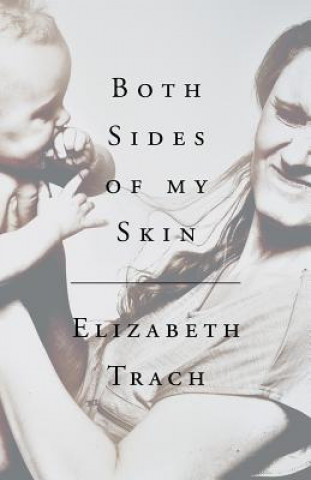 Könyv Both Sides of My Skin ELIZABETH TRACH