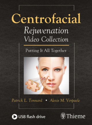 Wideo Centrofacial Rejuvenation Video Collection Patrick L. Tonnard