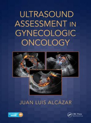 Kniha Ultrasound Assessment in Gynecologic Oncology Alcazar
