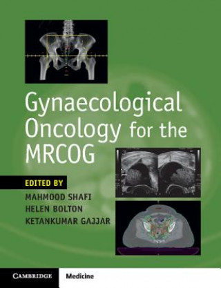 Carte Gynaecological Oncology for the MRCOG Mahmood Shafi