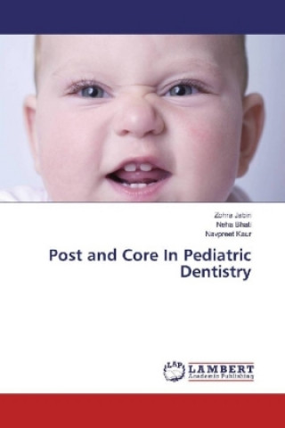 Könyv Post and Core In Pediatric Dentistry Zohra Jabin