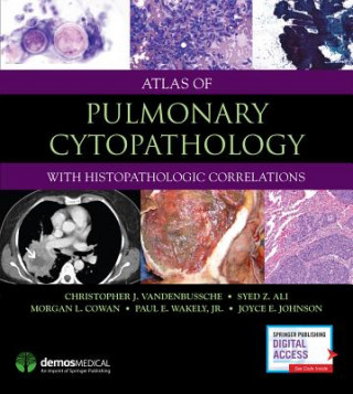 Kniha Atlas of Pulmonary Cytopathology Syed Z. Ali
