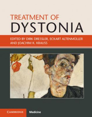 Kniha Treatment of Dystonia Dirk Dressler