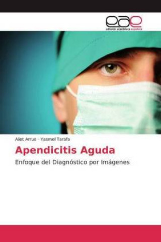 Книга Apendicitis Aguda Aliet Arrue