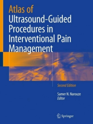 Knjiga Atlas of Ultrasound-Guided Procedures in Interventional Pain Management Samer N. Narouze