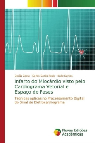 Książka Infarto do Miocardio visto pelo Cardiograma Vetorial e Espaco de Fases Cecilia Costa