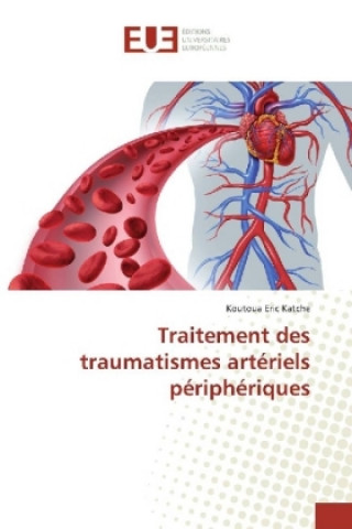 Carte Traitement des traumatismes artériels périphériques Koutoua Eric Katche