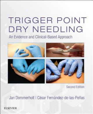 Könyv Trigger Point Dry Needling Jan Dommerholt