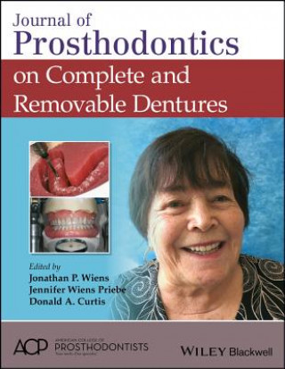 Könyv Journal of Prosthodontics on Complete and Removable Dentures Jonathan P. Wiens