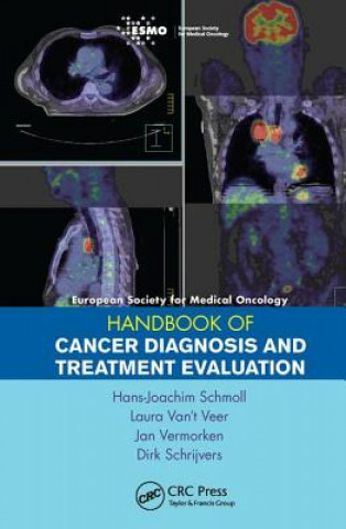 Knjiga ESMO Handbook of Cancer Diagnosis and Treatment Evaluation Dirk Schrijvers