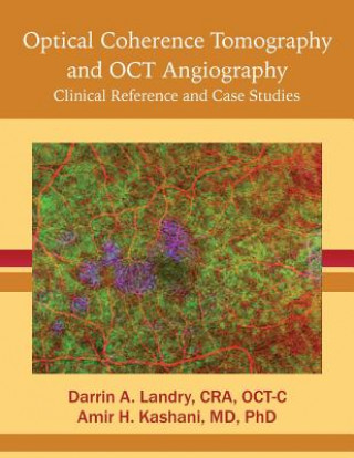 Kniha Optical Coherence Tomography and OCT Angiography: Clinical Reference and Case Studies Cra Oct Landry