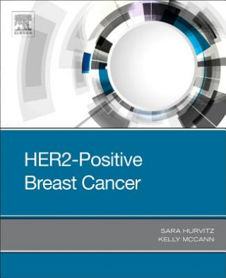 Kniha HER2-Positive Breast Cancer Hurvitz