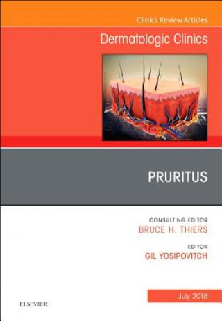 Book Pruritus, An Issue of Dermatologic Clinics Gil Yosipovitch