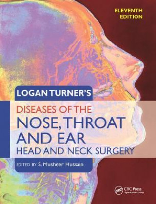 Könyv Logan Turner's Diseases of the Nose, Throat and Ear 