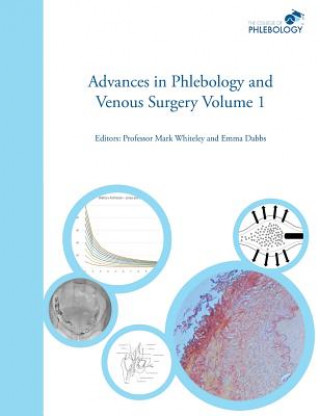 Kniha Advances in Phlebology and Venous Surgery Emma B Dabbs