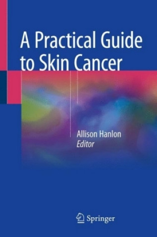Kniha Practical Guide to Skin Cancer Allison Hanlon