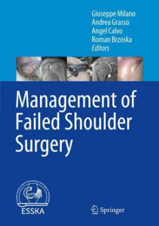 Książka Management of Failed Shoulder Surgery Giuseppe Milano