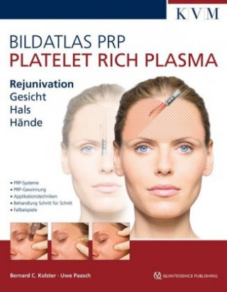 Книга Bildatlas Kollageninduktion mit Platelet Rich Plasma (PRP) Uwe Paasch