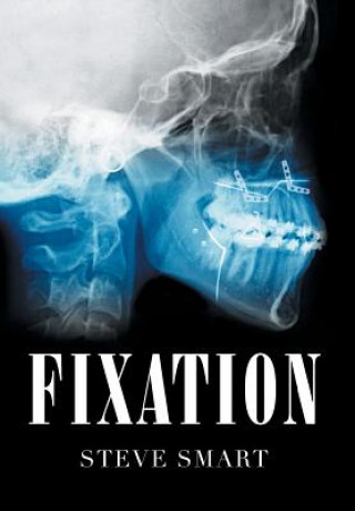 Knjiga Fixation STEVE SMART