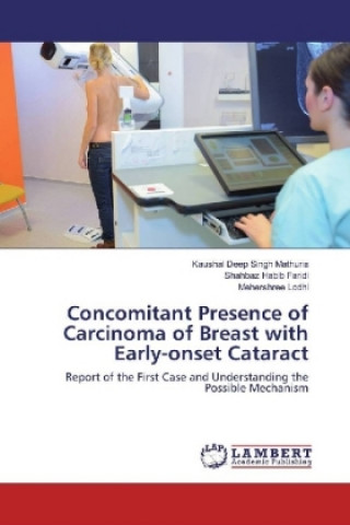 Książka Concomitant Presence of Carcinoma of Breast with Early-onset Cataract Kaushal Deep Singh Mathuria