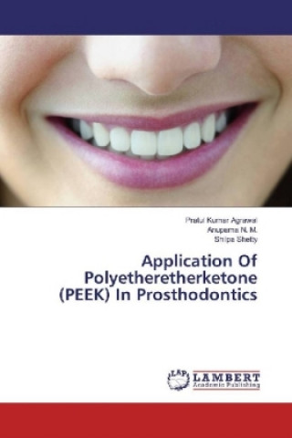 Kniha Application Of Polyetheretherketone (PEEK) In Prosthodontics Pratul Kumar Agrawal