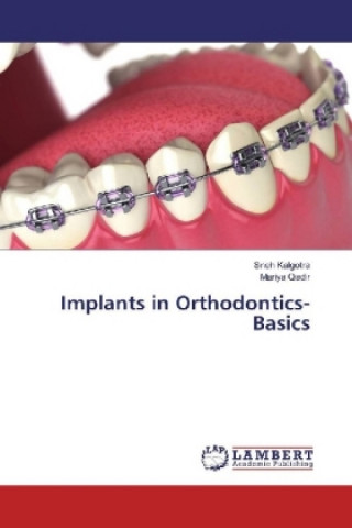 Knjiga Implants in Orthodontics- Basics Sneh Kalgotra