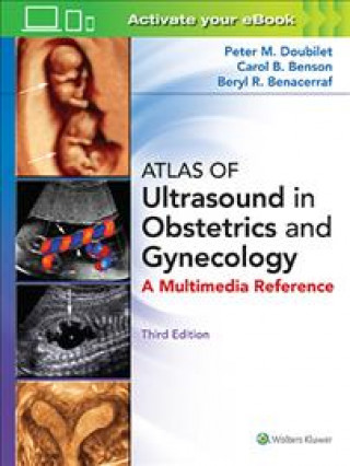 Книга Atlas of Ultrasound in Obstetrics and Gynecology Peter M. Doubilet