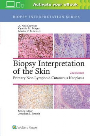 Kniha Biopsy Interpretation of the Skin A. Neil Crowson