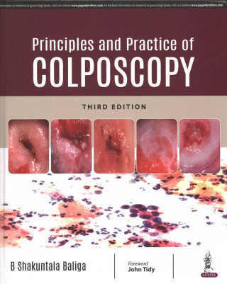 Buch Principles and Practice of Colposcopy B Shakuntala Baliga