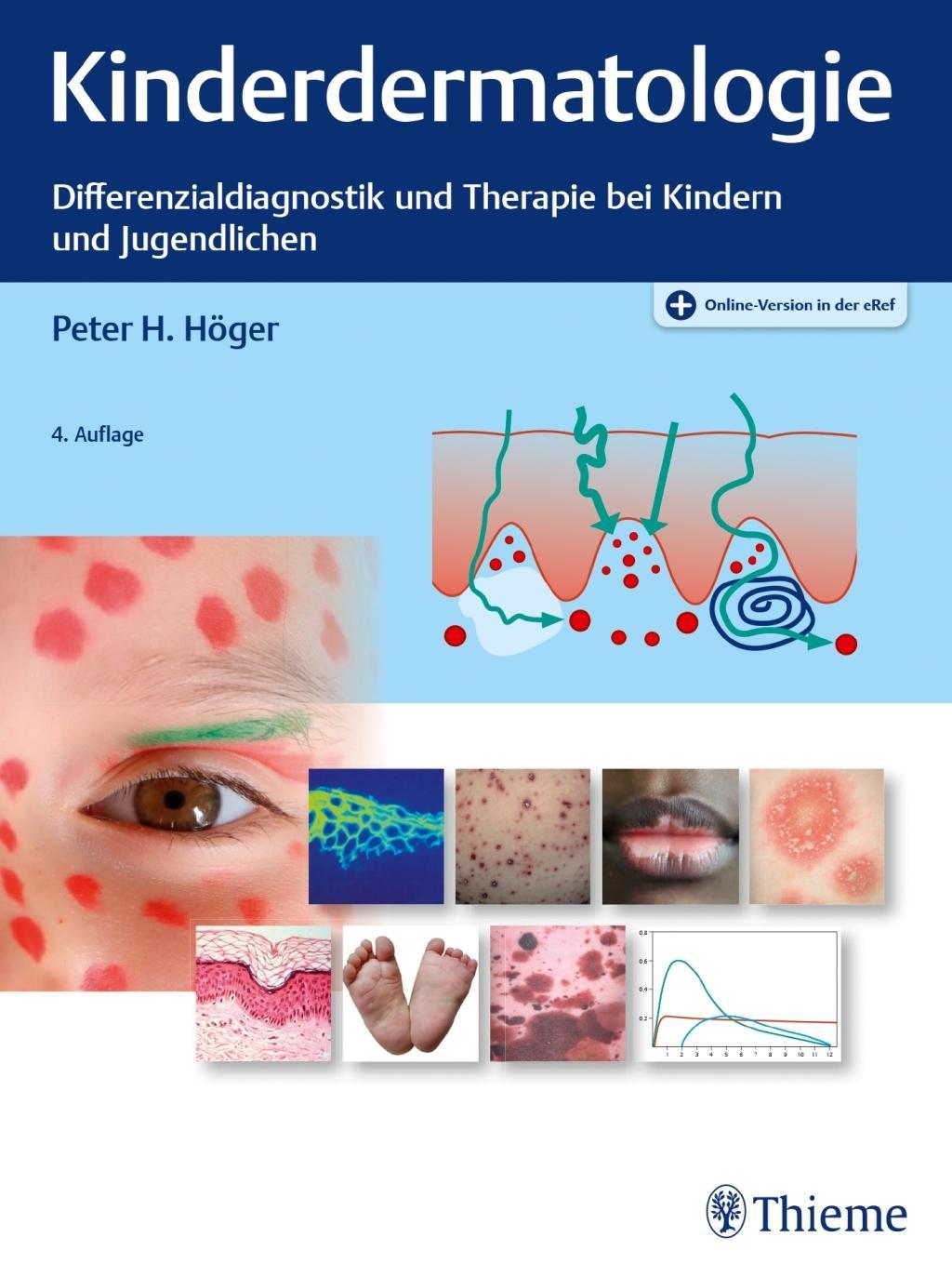 Könyv Kinderdermatologie Peter H. Höger