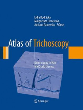 Könyv Atlas of Trichoscopy Lidia Rudnicka