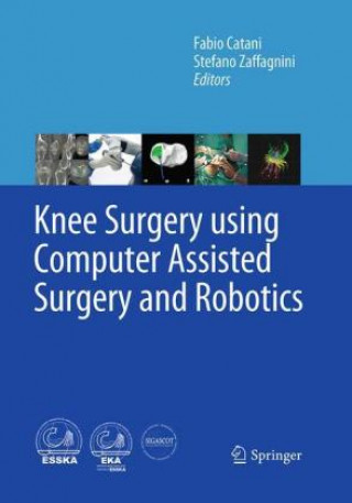 Book Knee Surgery using Computer Assisted Surgery and Robotics Fabio Catani