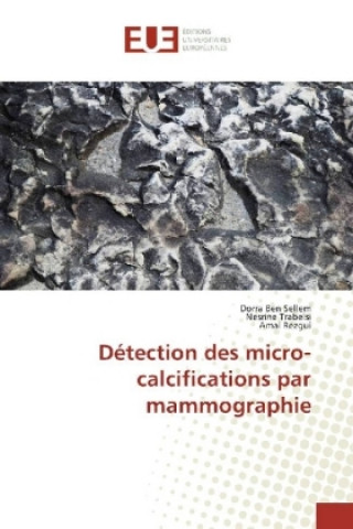 Kniha Détection des micro-calcifications par mammographie Dorra Ben Sellem