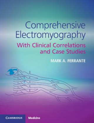 Book Comprehensive Electromyography Mark A. (University of Tennessee) Ferrante