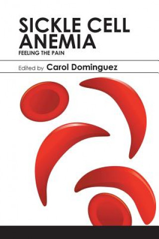 Knjiga Sickle Cell Anemia CAROL DOMINGUEZ