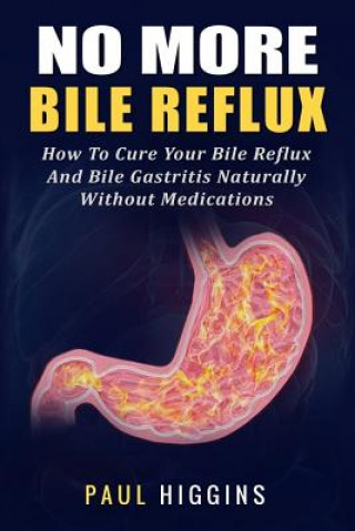 Könyv No More Bile Reflux: How to Cure Your Bile Reflux and Bile Gastritis Naturally Without Medications Paul Higgins