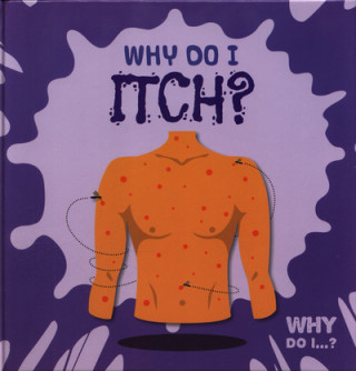 Könyv Why Do I Itch? Kirsty Holmes