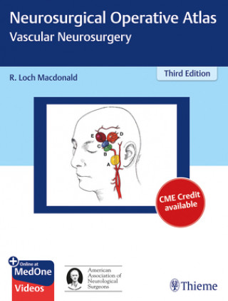 Könyv Neurosurgical Operative Atlas: Vascular Neurosurgery R. Loch Macdonald