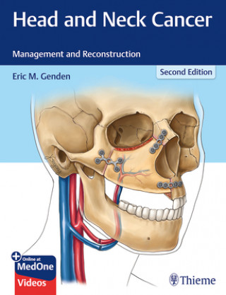 Knjiga Head and Neck Cancer Eric M. Genden