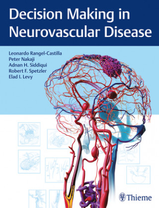 Knjiga Decision Making in Neurovascular Disease Leonardo Rangel-Castilla