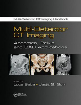 Kniha Multi-Detector CT Imaging 