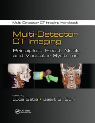 Buch Multi-Detector CT Imaging 